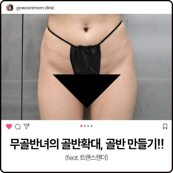 무골반녀의 골반확대, 골반만들기!(feat. 트랜스젠더)