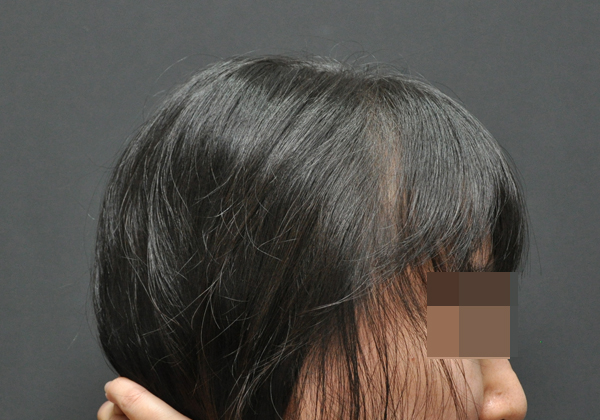 전후이미지