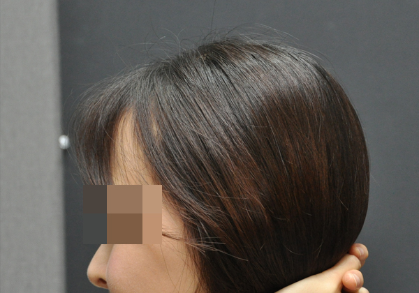 전후이미지
