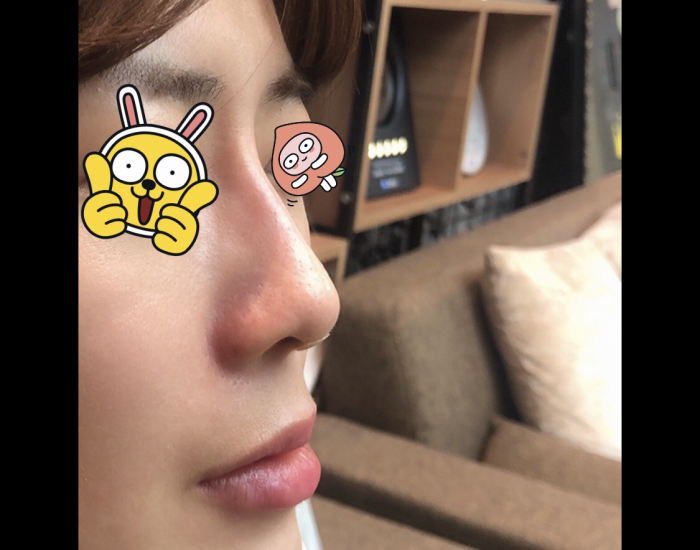 코