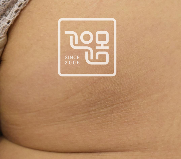 전후이미지
