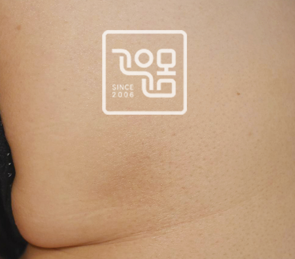 전후이미지