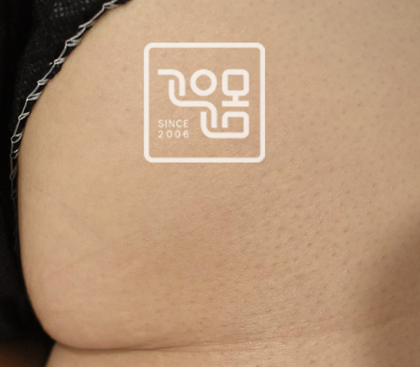 전후이미지