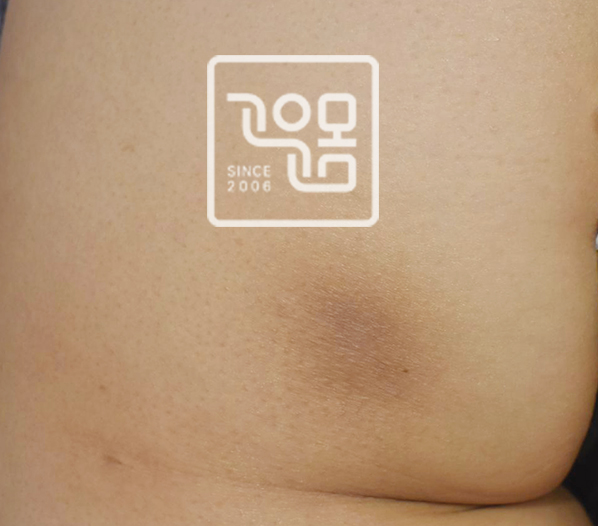 전후이미지