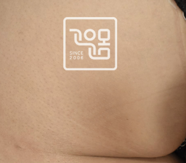 전후이미지