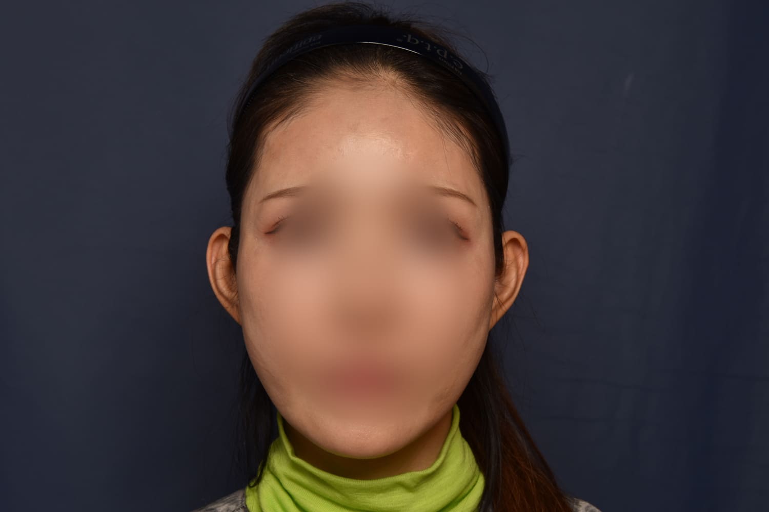 전후이미지
