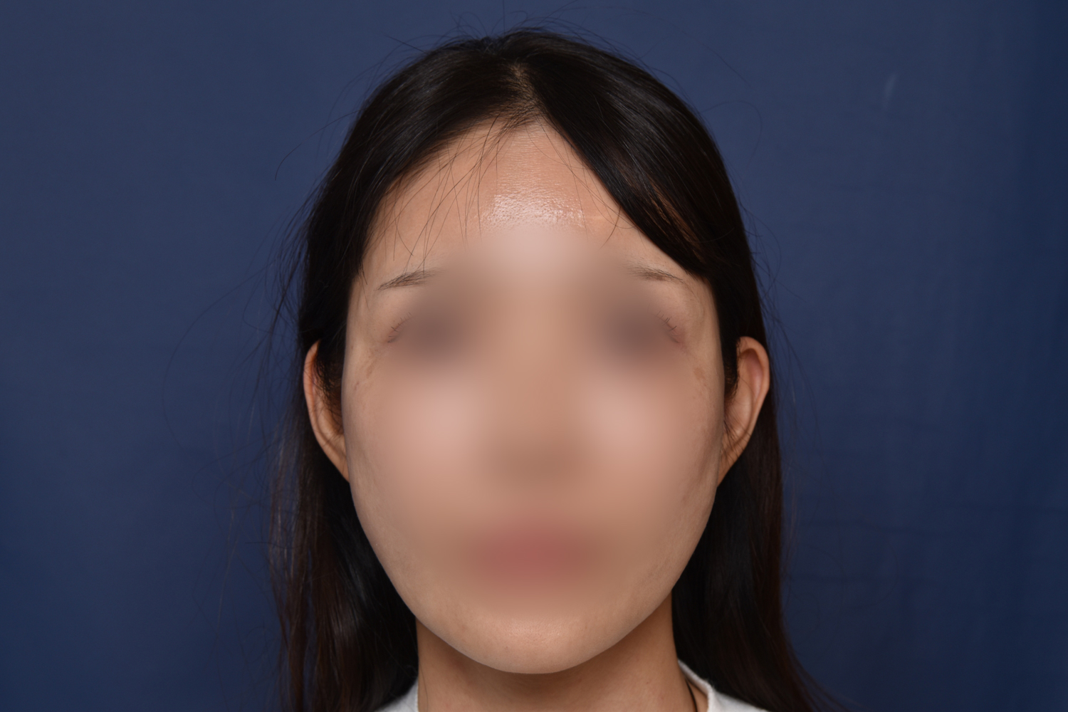 전후이미지