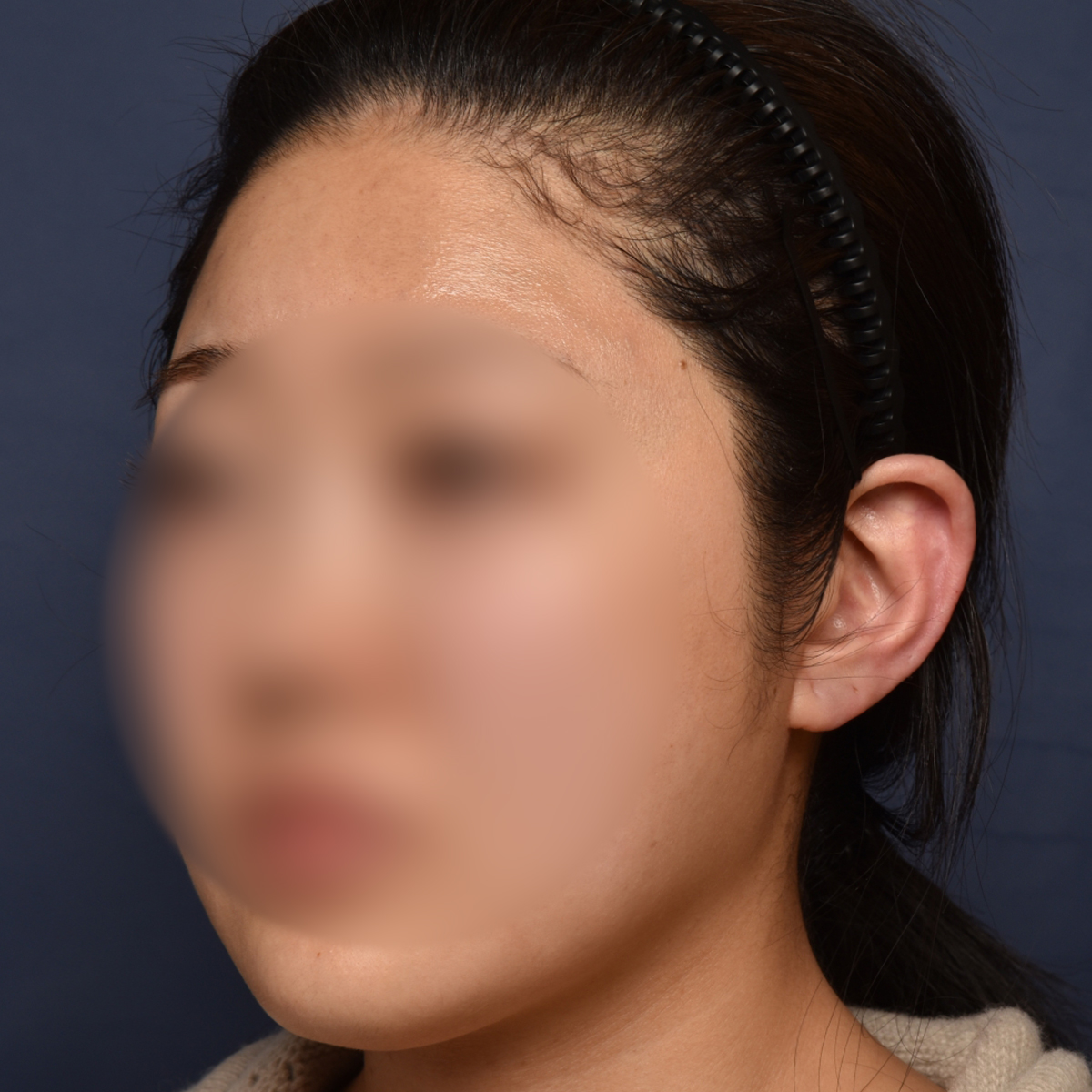 전후이미지