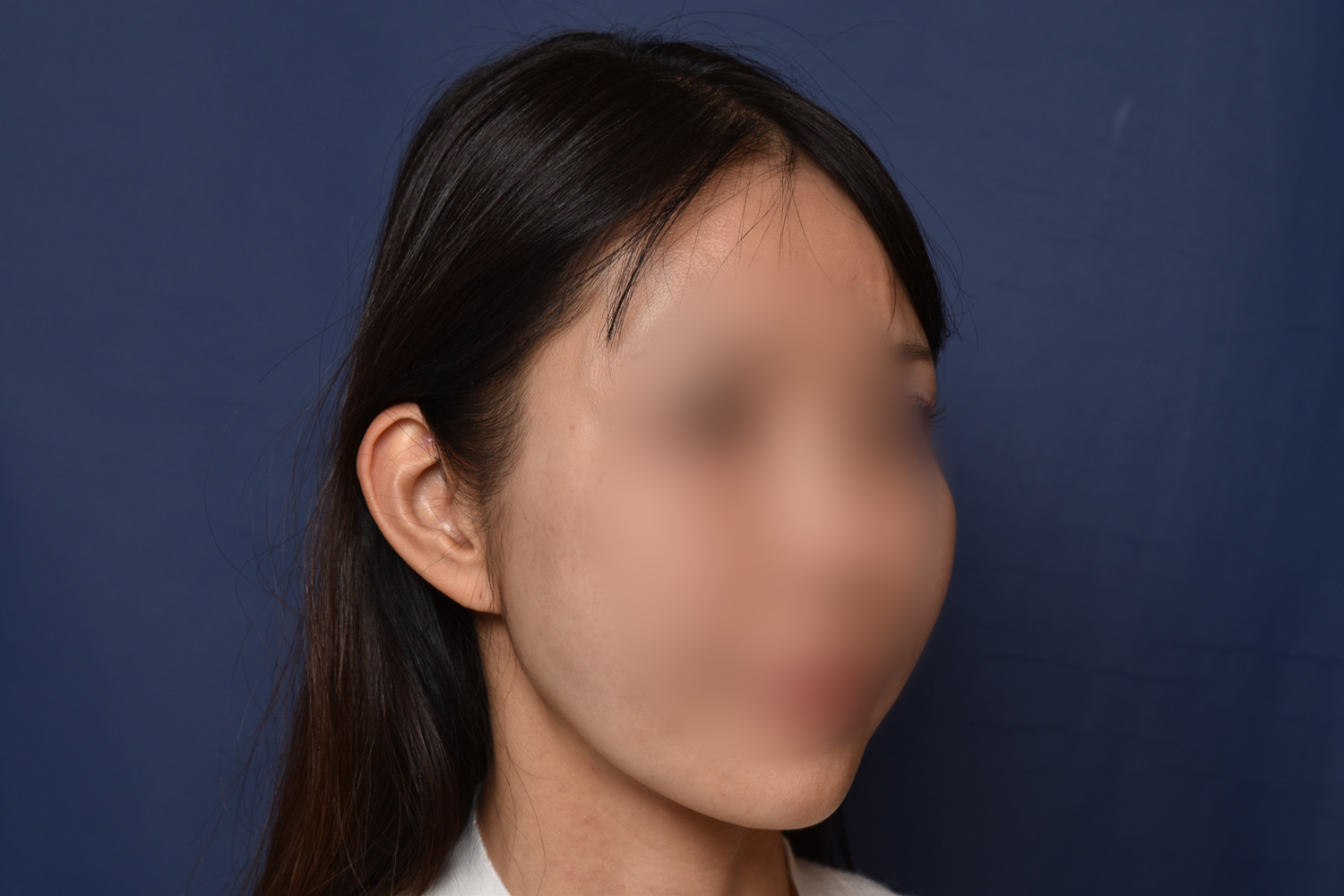 전후이미지