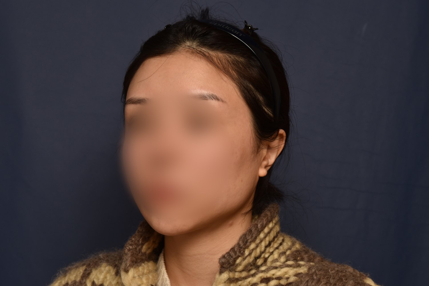전후이미지