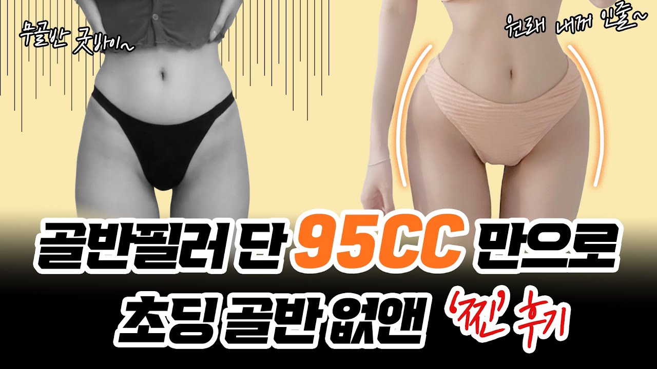 베트남까지 소문난 골반필러! 핫바디 인플루언서 서윤님(Ngan) 방문 &amp; 골반필러 찐 후기!