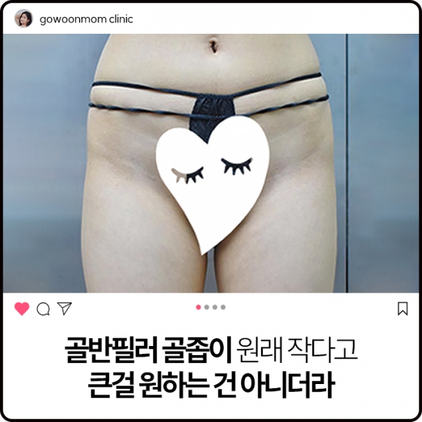 골반필러 골좁이:  원래 작다고 큰걸 원하는 건 아니더라.
