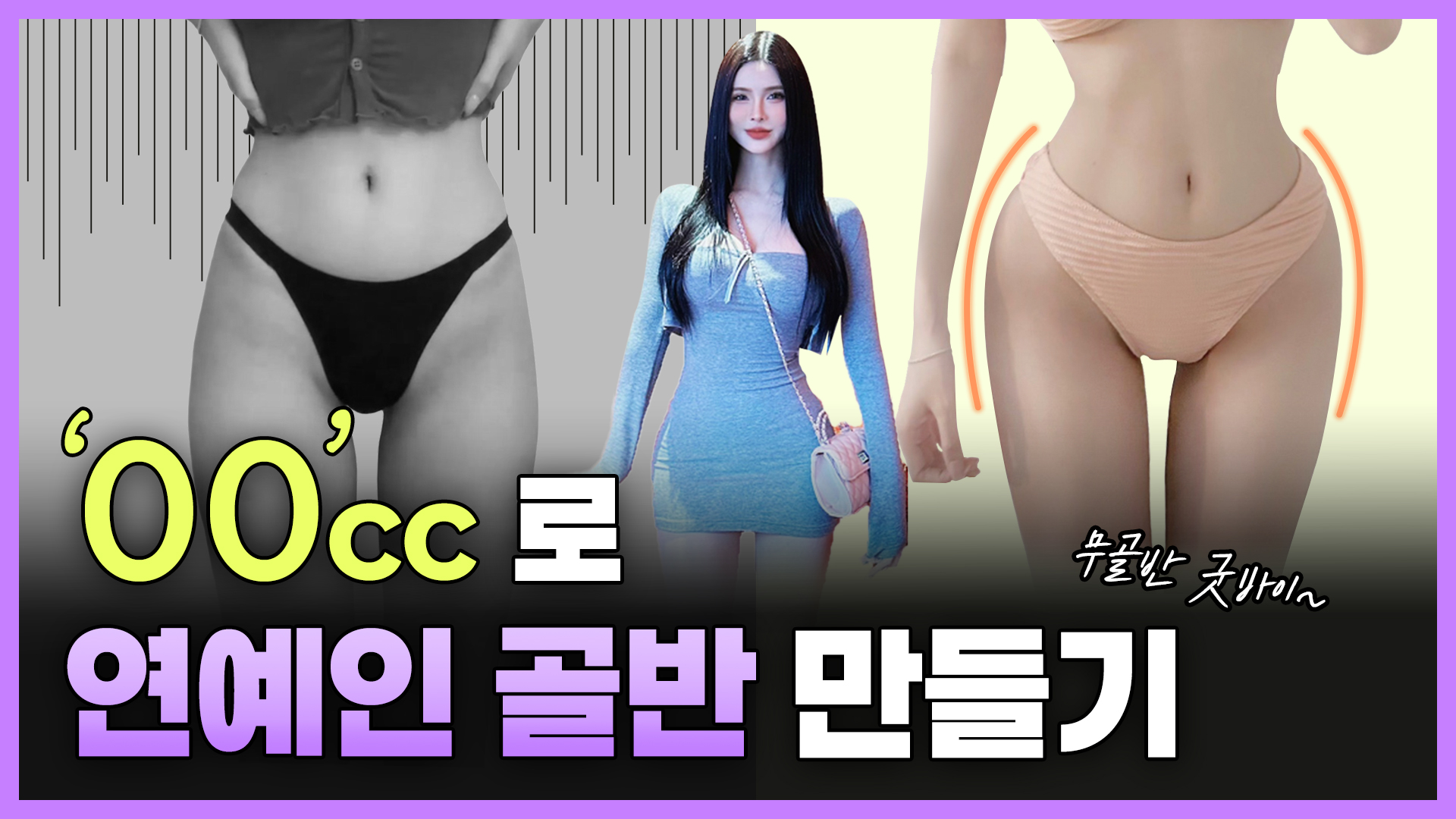 베트남까지 소문난 골반필러! 핫바디 인플루언서 서윤님(Ngan) 방문 &amp; 골반필러 찐 후기!