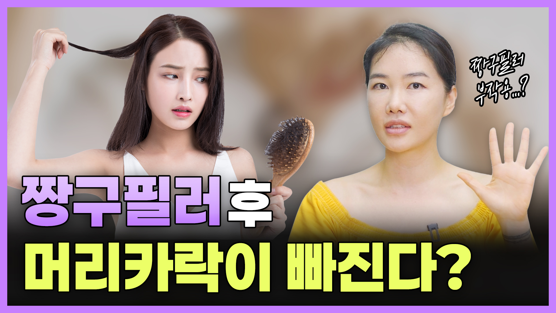 짱구필러 후 머리카락이 빠진다?! 두상필러 후 탈모의 진실