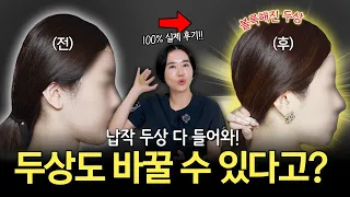 두상 콤플렉스 있다면 꼭 봐야할 영상! 두상도 바꿀 수 있어요