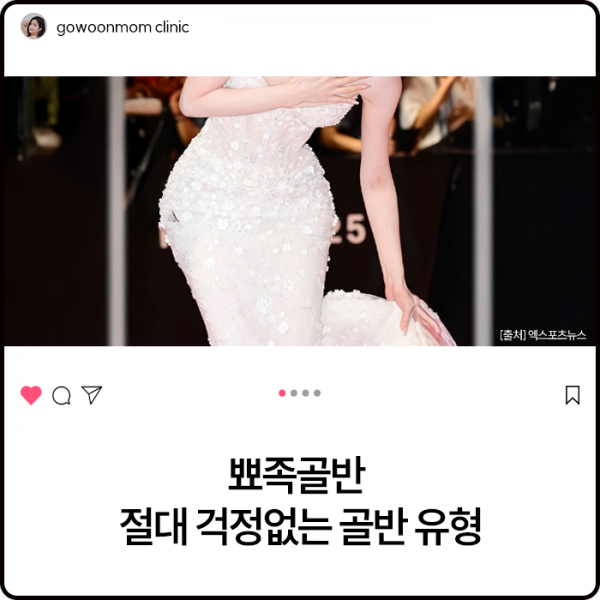 뾰족골반 절대 걱정 없는 골반유형